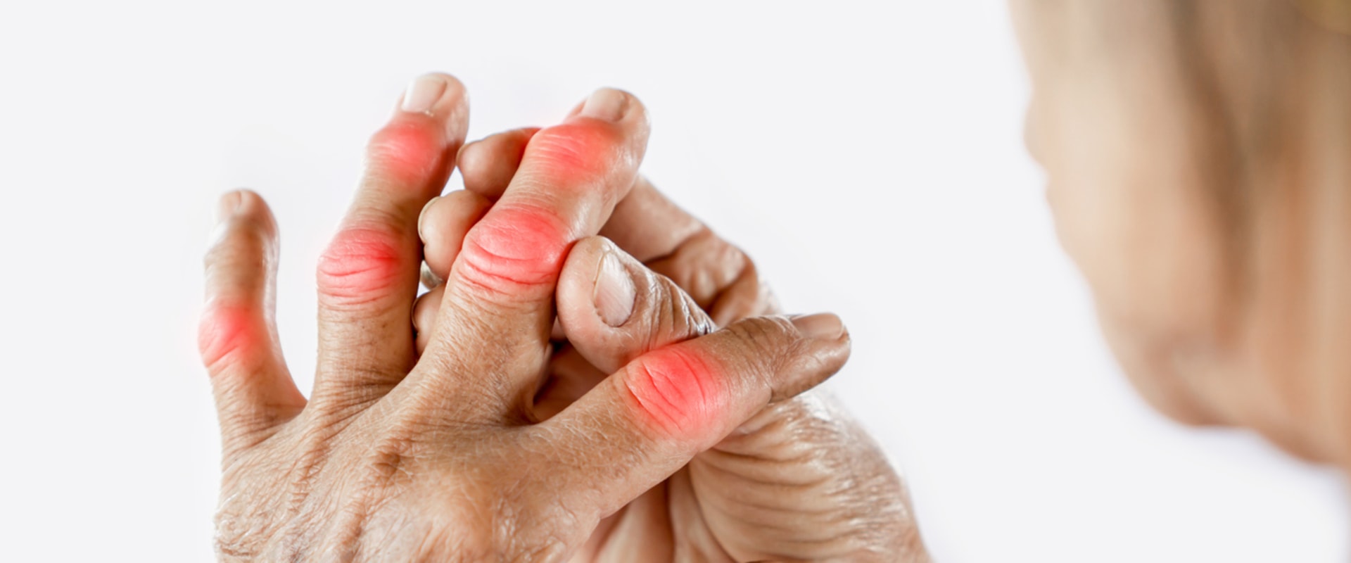 Coping with Arthritis in the Family What You Need to Know