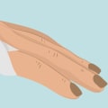 Preventing Arthritis: The Best Ways to Reduce Your Risk