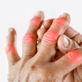 Coping with Arthritis in the Family: What You Need to Know