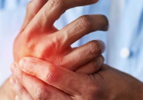 How to Prevent Arthritis from Developing