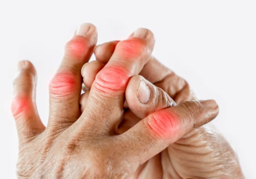 Coping with Arthritis in the Family: What You Need to Know